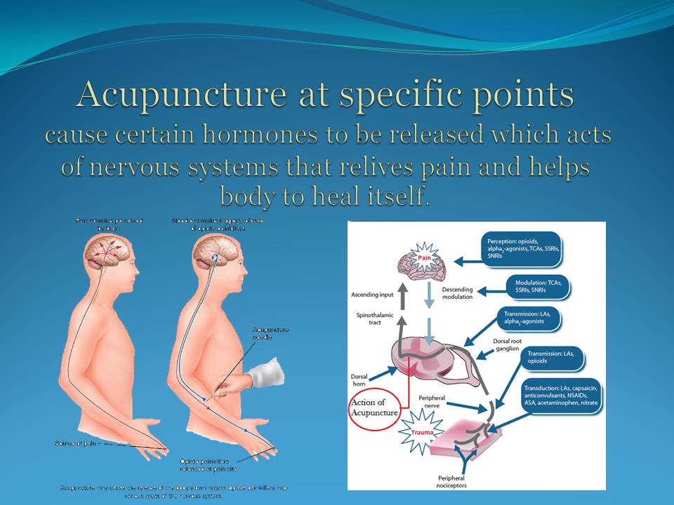 Acupuncture Slide Show